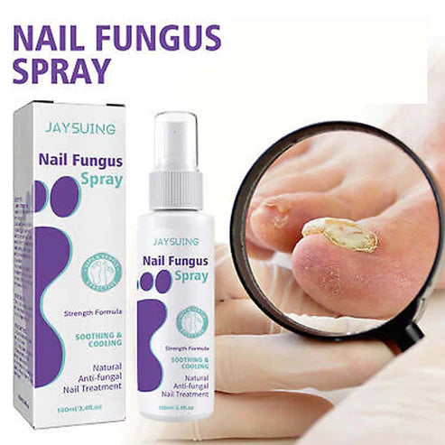 Nail Fungus Spray! 💥🦶